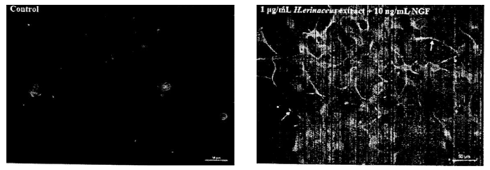 Image comparison showing how neurons in the brain go dormant over time